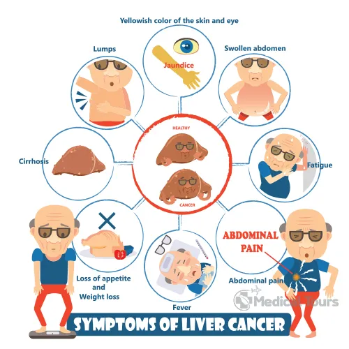 Liver Cancer